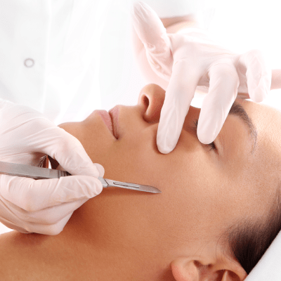 DERMAPLANING